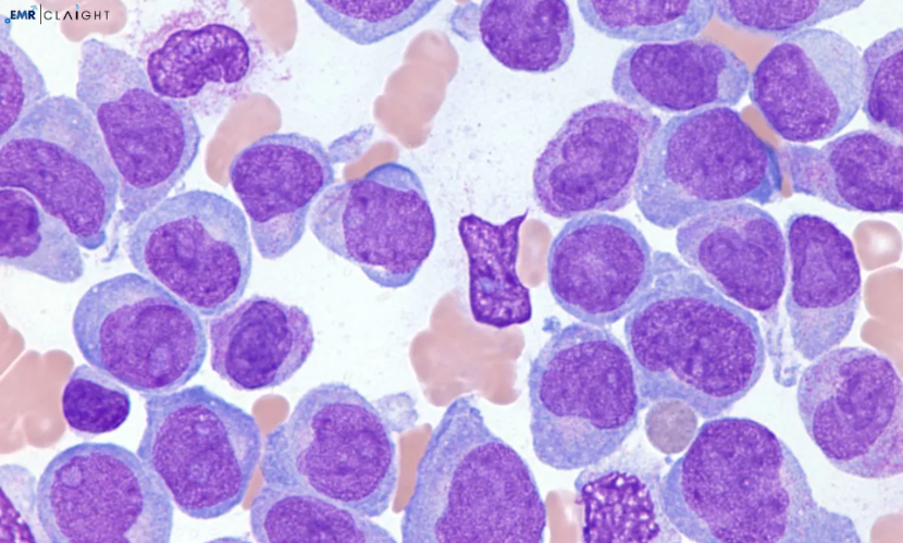 Global Acute Myeloid Leukemia Treatment Market