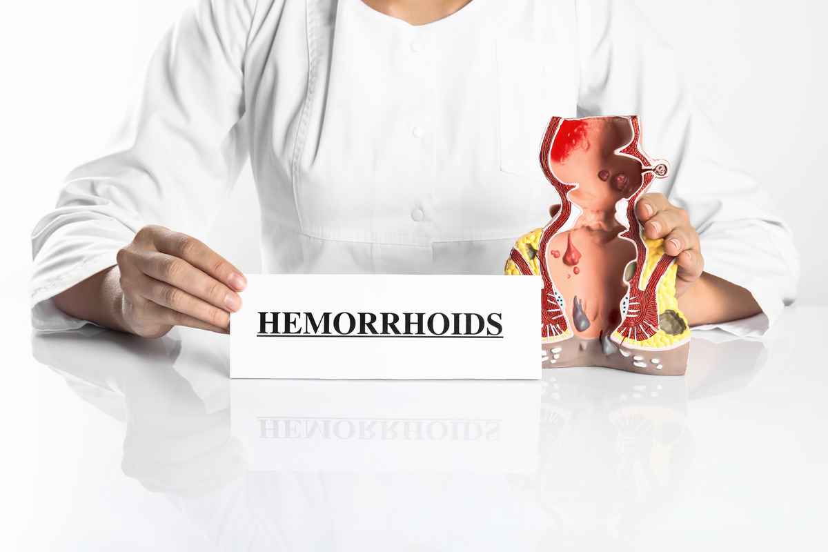 hemorrhoid cream