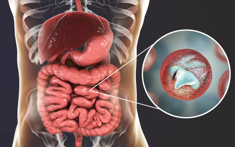 How Nizonide Effectively Treats Intestinal Parasites