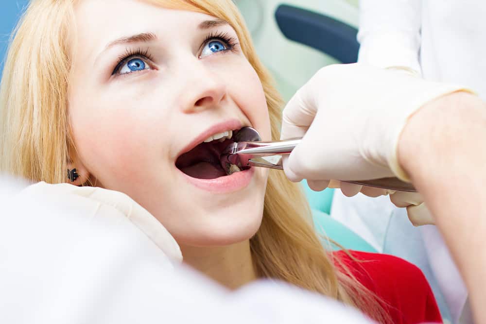 Do’s and Don’ts After Wisdom Tooth Extraction