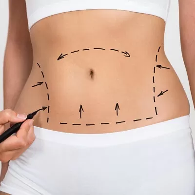 The Best Liposuction Surgeon in Dubai: A Comprehensive Guide to Choosing the Right One