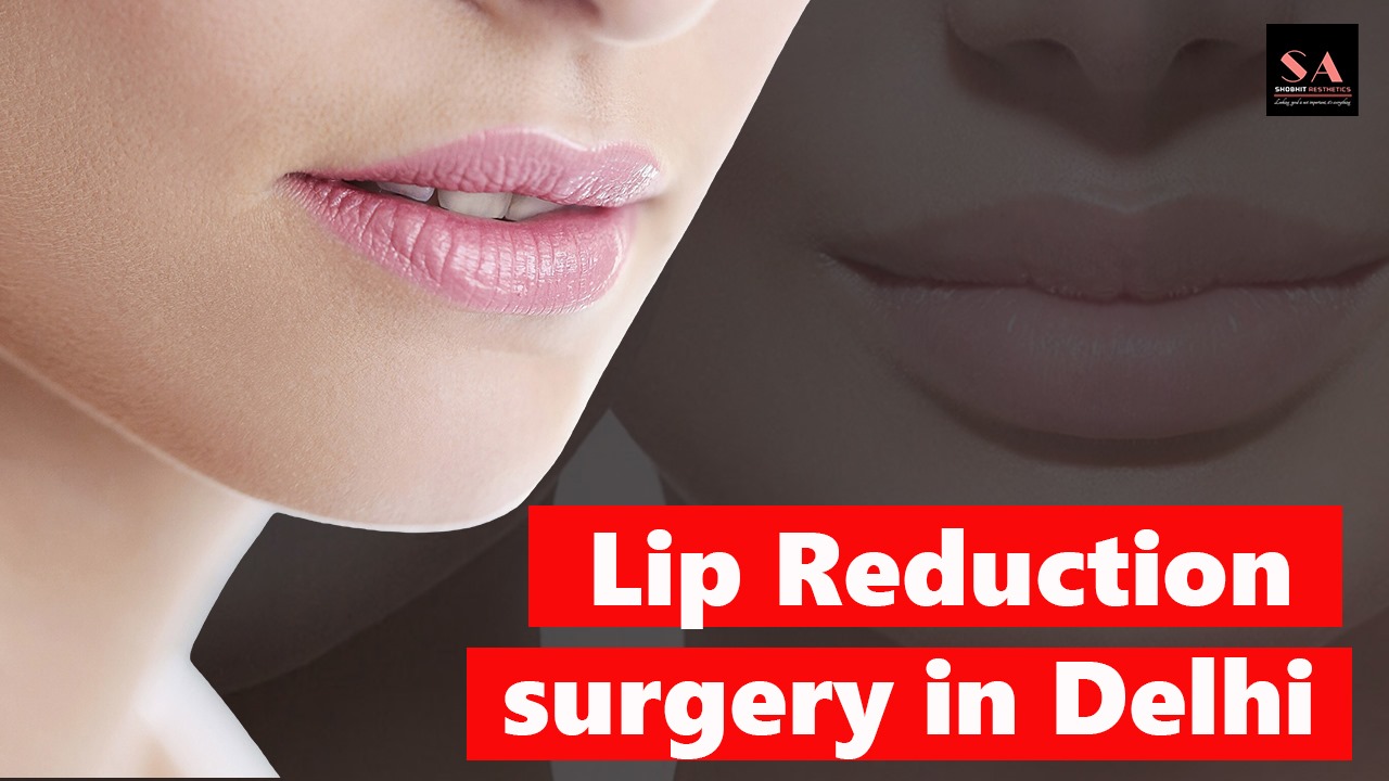 Lip Fillers