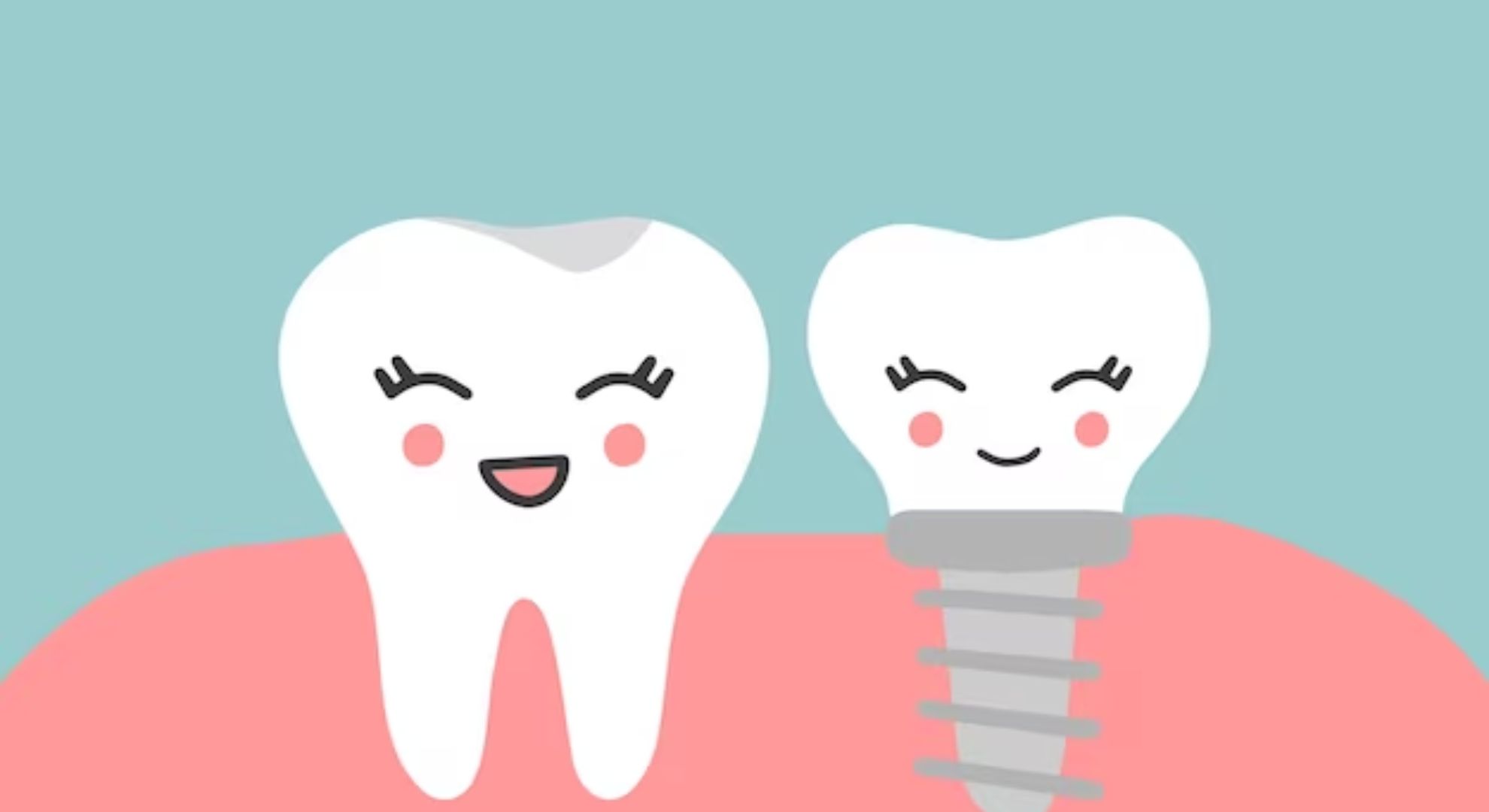 dental implants images