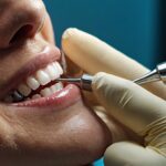 Top 10 Benefits of Porcelain Veneers for a Beautiful, Lasting Smile