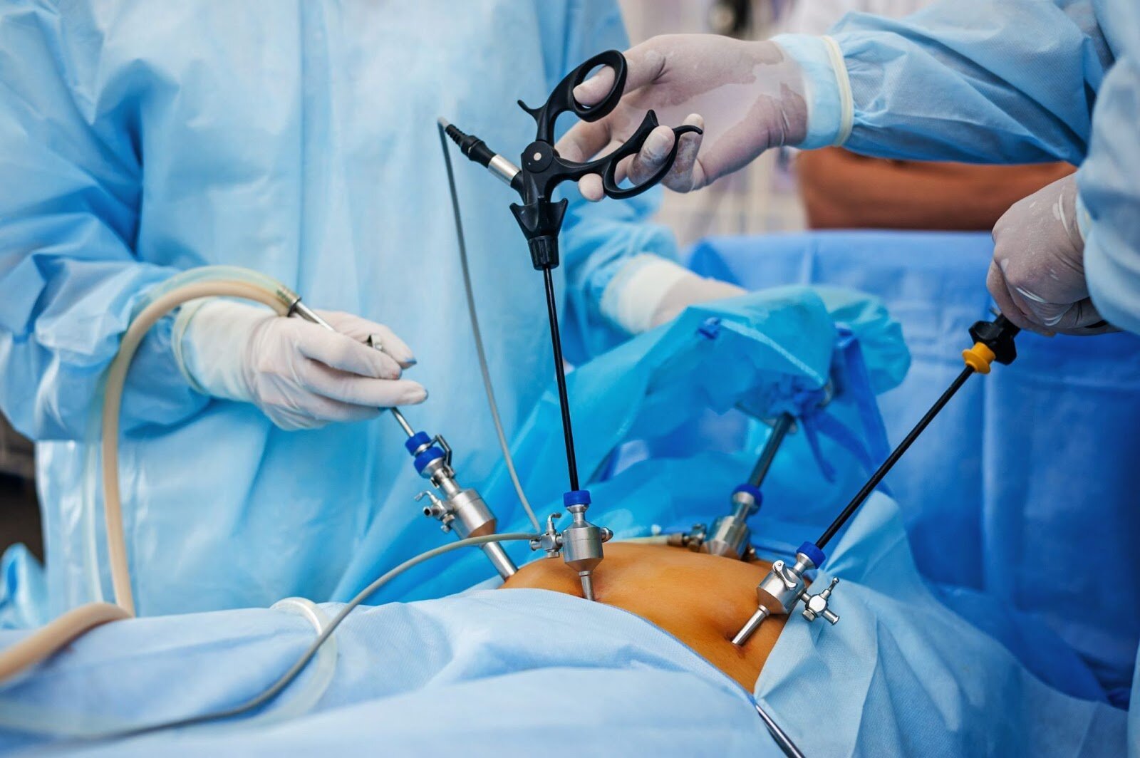 laparoscopic doctor