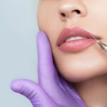 Dermal fillers in Islamabad