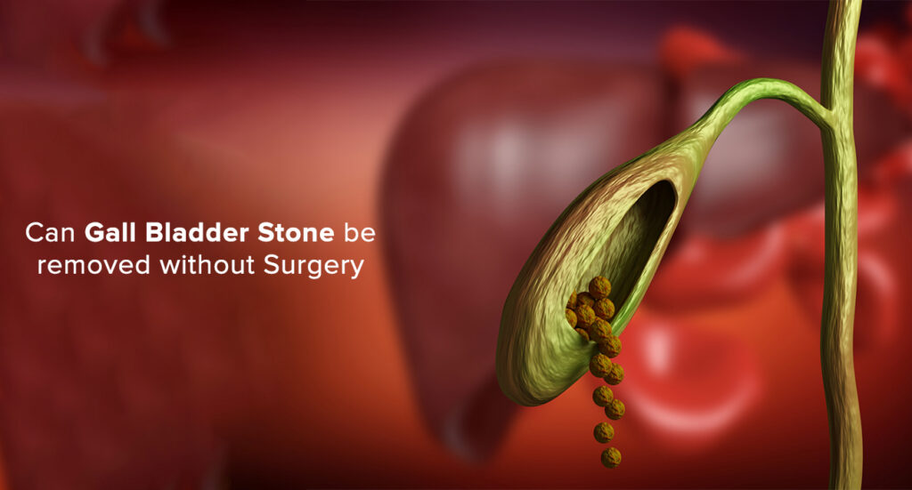 gallbladder13-1024x551 Gallbladder Stone Removal: Everything You Need to Know