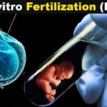 IVF Treatment