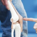 Knee Replacement Surgery Cost in Pakistan