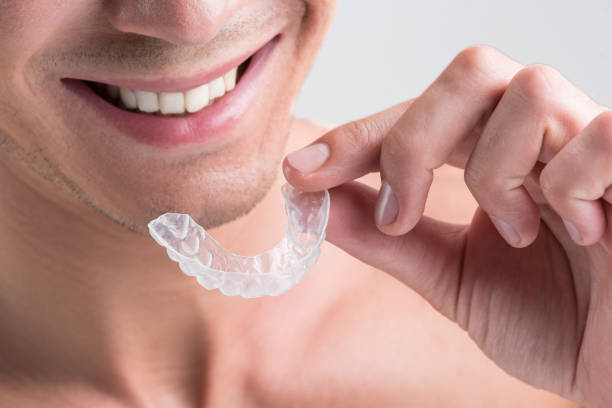 Aligners for Teeth