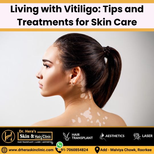 Tips and treatments for skin care