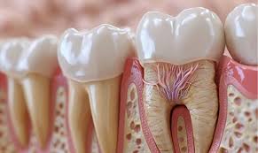 Root Canal Treatment