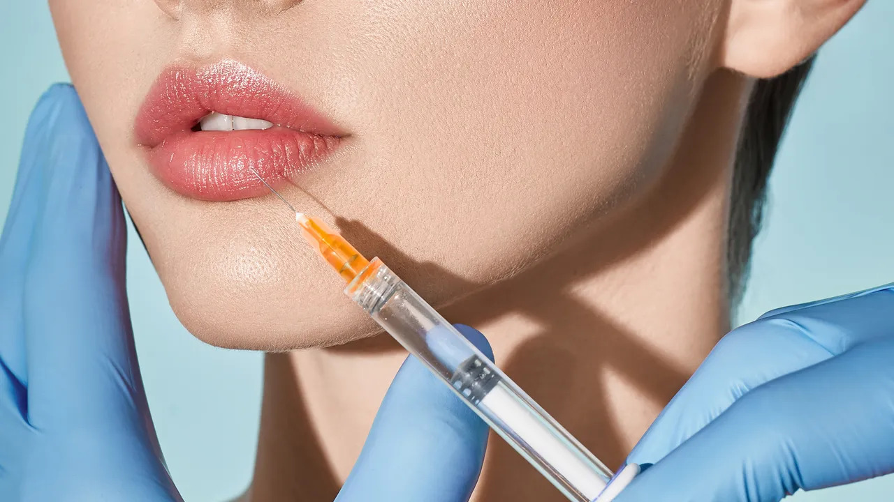 The Ultimate Guide to Lip Filler Injections for a Perfect Pout