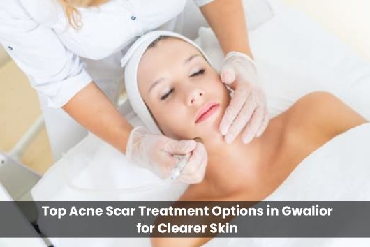 Girl having Acne scar treatment