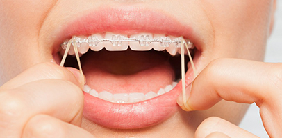 Orthodontic Care