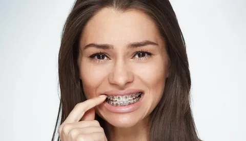 Dental braces in Islamabad