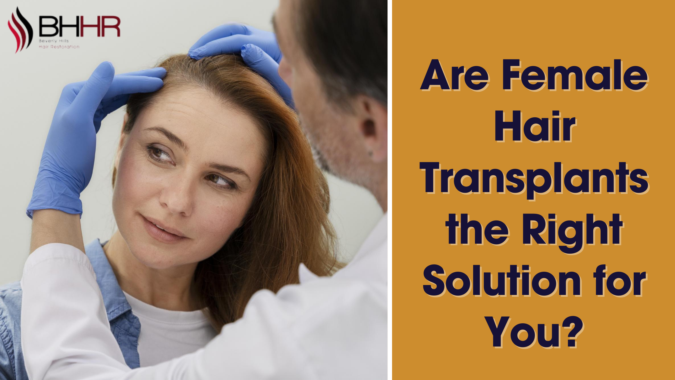 female hair transplant