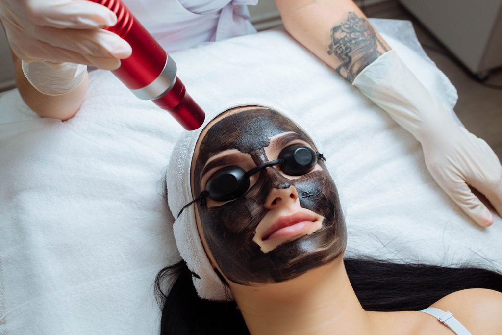 Glow Up, Discover the Benefits of Laser Carbon Peels for Radiant Skin