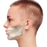 Jaw surgery in Islamabad