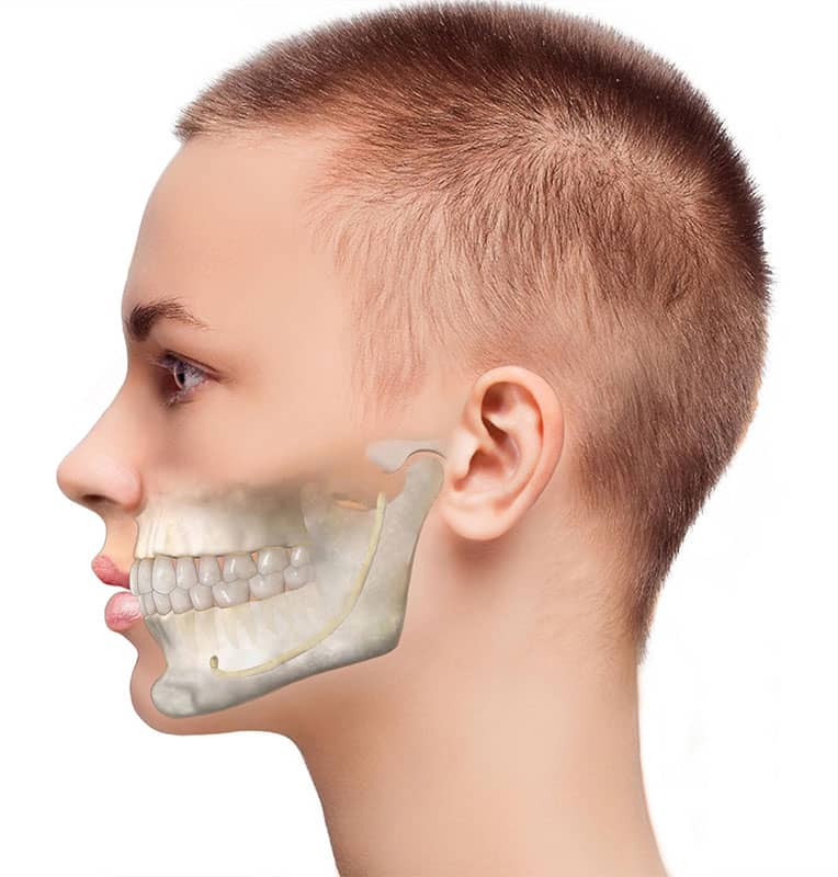 Jaw surgery in Islamabad