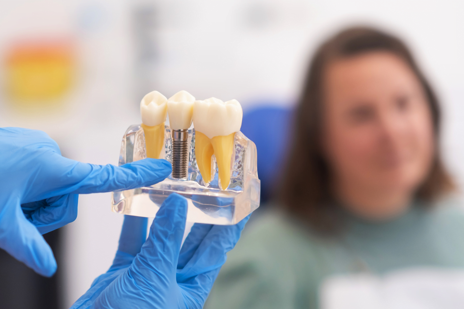 Dental Implants in Islamabad