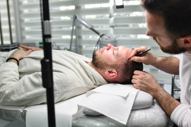 زراعة الشعر في دبي