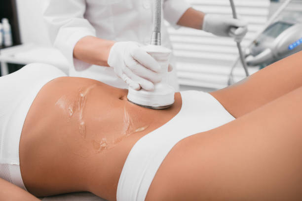 How Much Fat Can Be Removed with Laser Liposuction