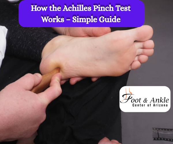 Achilles Pinch Test