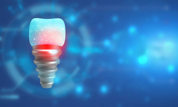 Is a Single Dental Implant Painful? Understanding the Procedure and Recovery