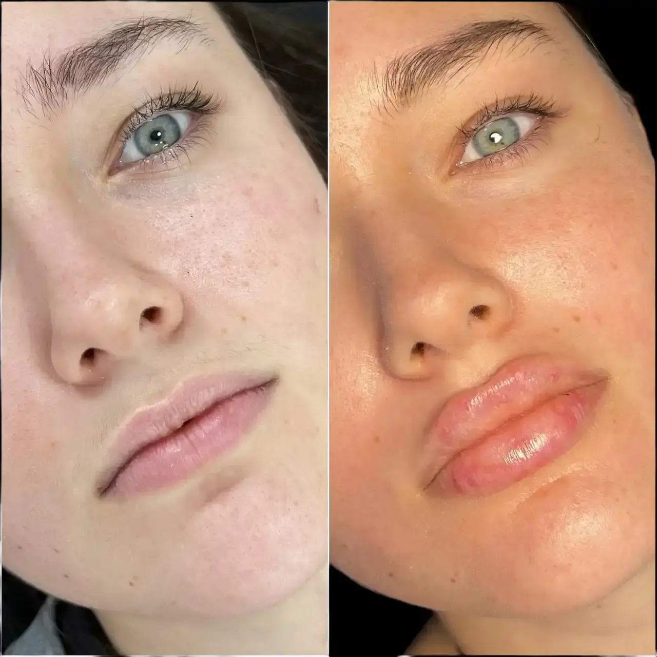 Best Aesthetic Clinic in dubai