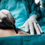Choosing the Right Surgeon for Your Fat Transfer Surgery in Dubai