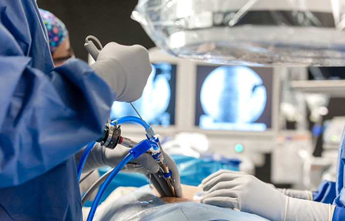 spine surgery Stewart