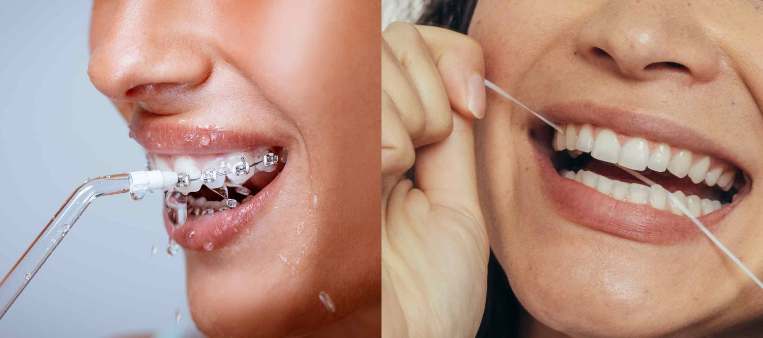 Dental Flossers Better Than Traditional Floss
