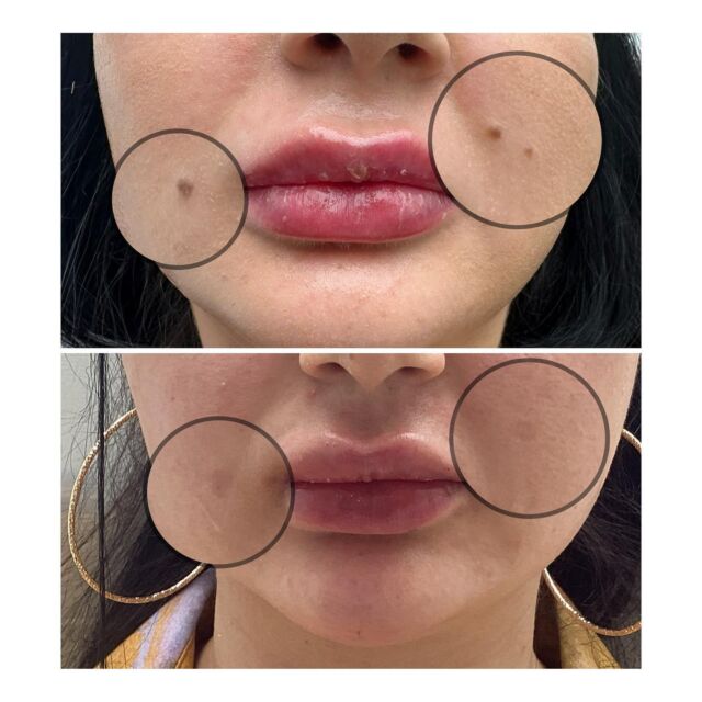 skin care clinic melbourne