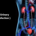 UTI