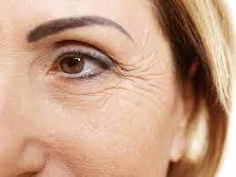 Can Microneedling Improve Wrinkles and Fine Lines