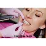 Dental Veneers