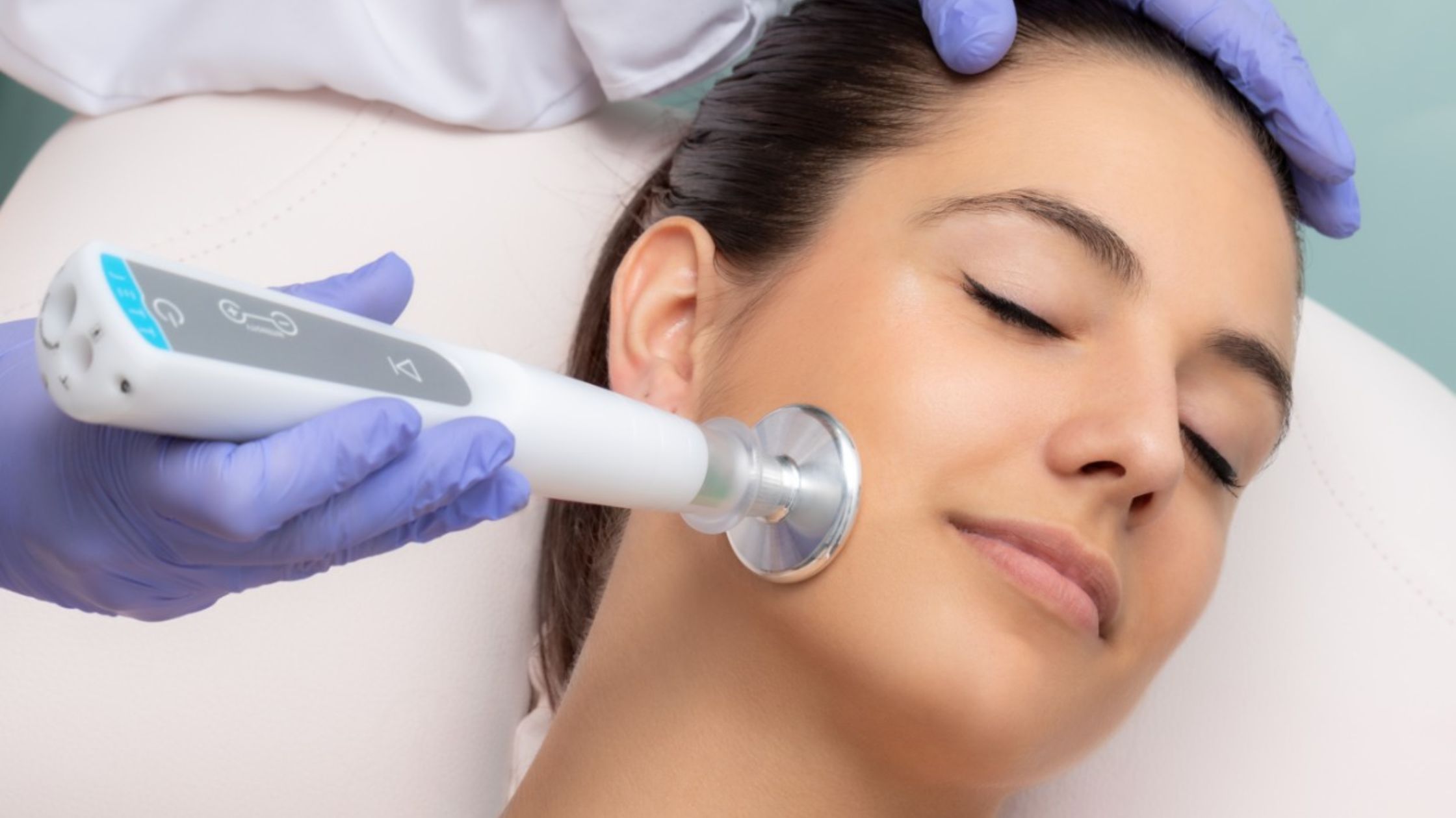 skin resurfacing in Guelph