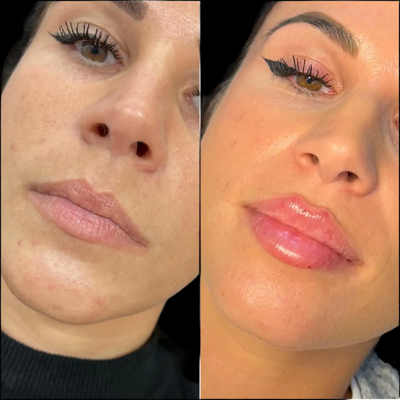 Best Plastic Surgeons in dubai