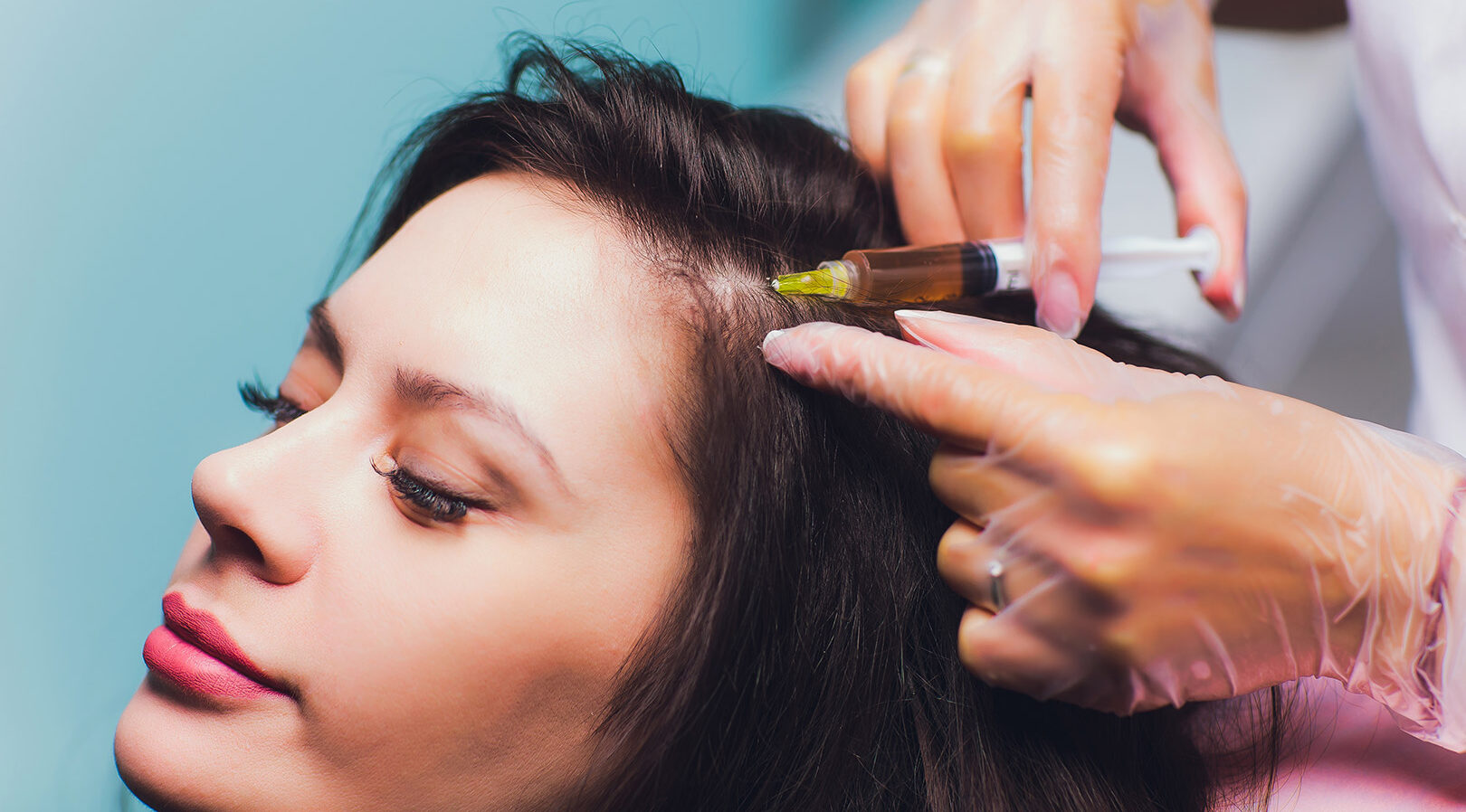 PRP Treatment Cost in Dubai