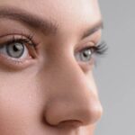How to Handle Bruising After Rhinoplasty