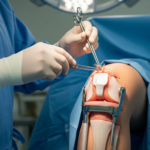 Regain Life Without Pain: Discover the Future of Mobility with Robotic Knee Replacement in Ludhiana