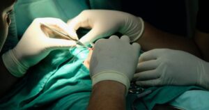 Minor Skin Surgery for Tags