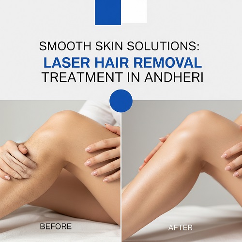 Smooth Skin Solutions: Laser Hair Removal Treatment in Andheri