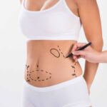 Liposuction in Islamabad