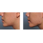Jaw surgery in Islamabad