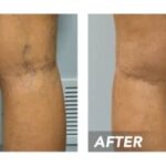 when to see a vascular doctor